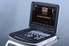 【彩超機】彩超設備能檢查出什么？